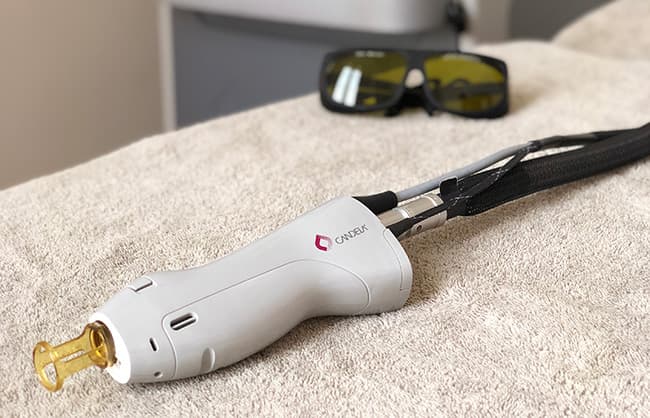 Photo du laser épilatoire de marque Candela utilisé au sein du cabinet du Dr Emma Lavocat à Bordeaux