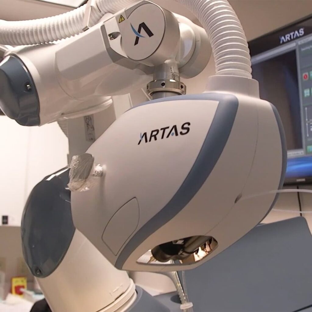 Robot Artas utilisé au sein du cabinet du Dr Emma Lavocat à Bordeaux pour la greffe de cheveux robotisée