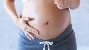 Une femme enceinte s'applique une crème préventive contre les vergetures sur le ventre