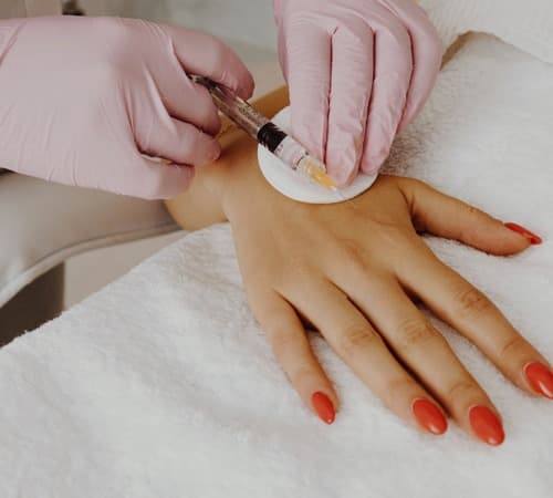 Injection de Skinboosters pour améliorer l'esthétique des mains par le Dr Emma Lavocat à Bordeaux