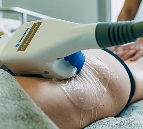 Gros plan sur applicateur Coolsculpting durant une séance de cryolipolyse au sein du cabinet du Dr Emma Lavocat à Bordeaux
