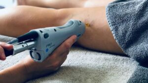 Séance de traitement des varicosités par laser sur les jambes au sein du Dr Emma Lavocat